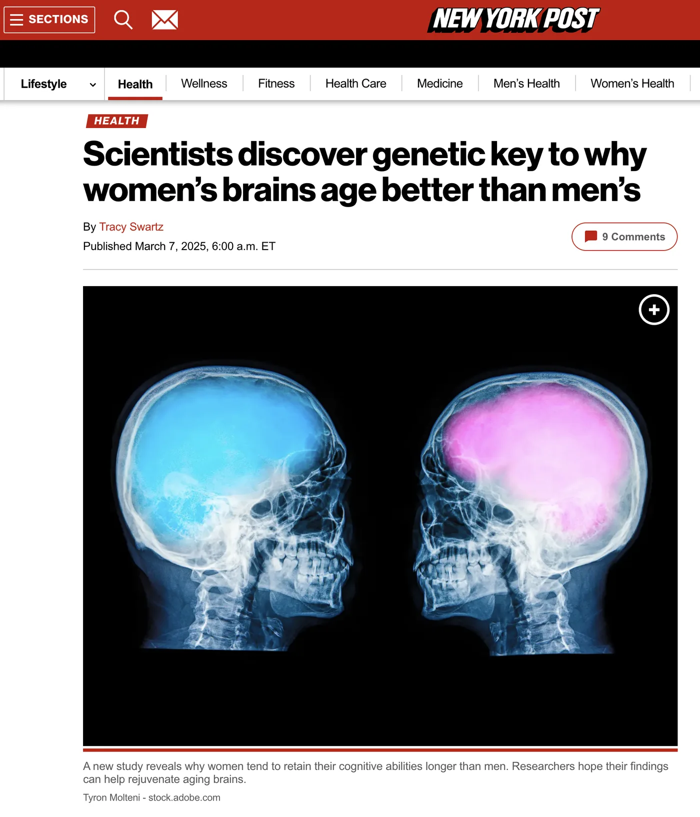 Articolo New York Post sulla ricerca scientifica legata al cervello femminile